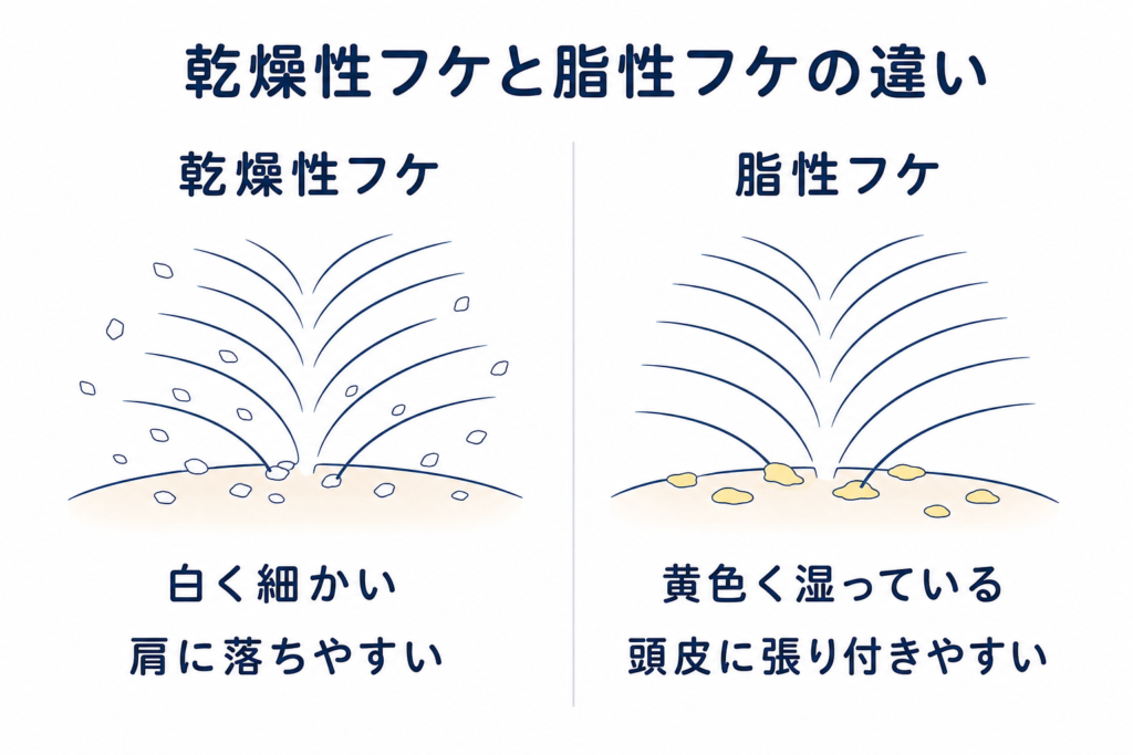 白く細かい乾燥性フケと黄色く湿った脂性フケの違い