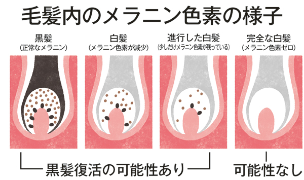 白髪初期の見分け方