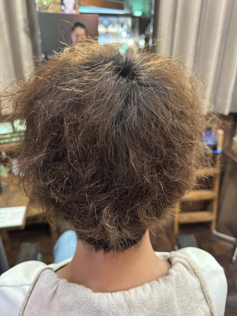 夏の屋外活動でカラーが褪色したショートヘアの施術前後ろ姿